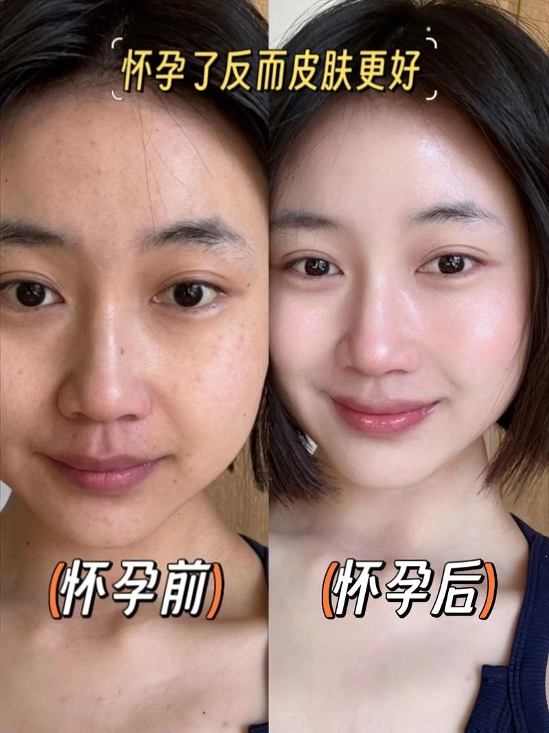 怀男孩女孩,皮肤变化有何不同?