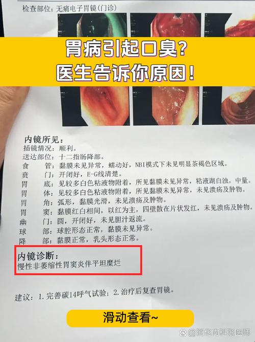 口腔厌氧菌口臭真无法根治?