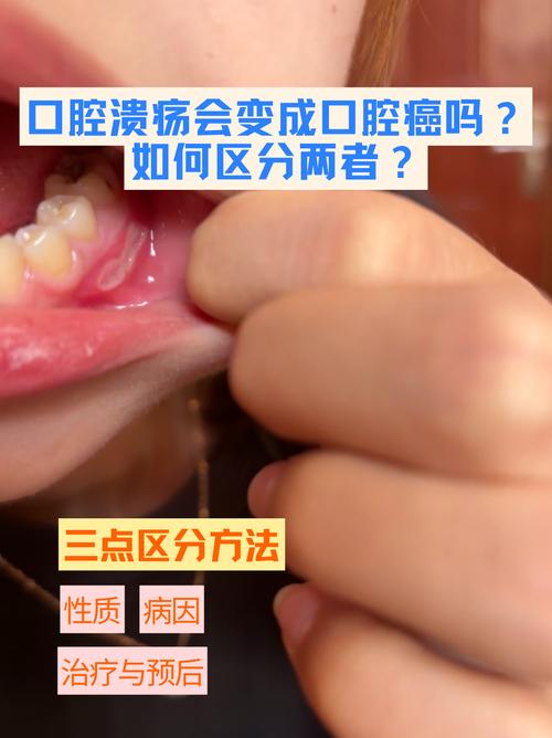 口腔溃疡频发,究竟为何总缠上你?