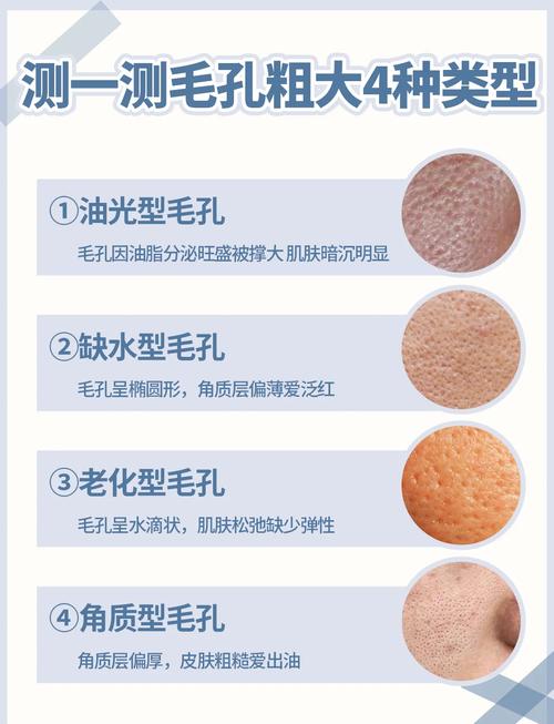 油皮毛孔粗大,护肤品选对了吗?