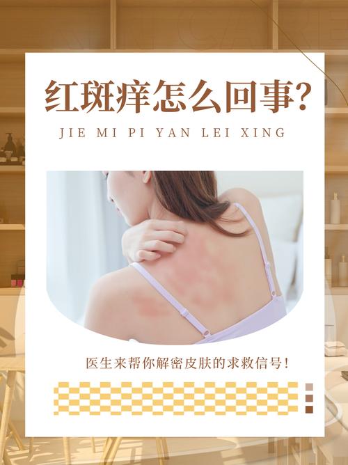 全身皮肤瘙痒背后藏着哪些健康信号?