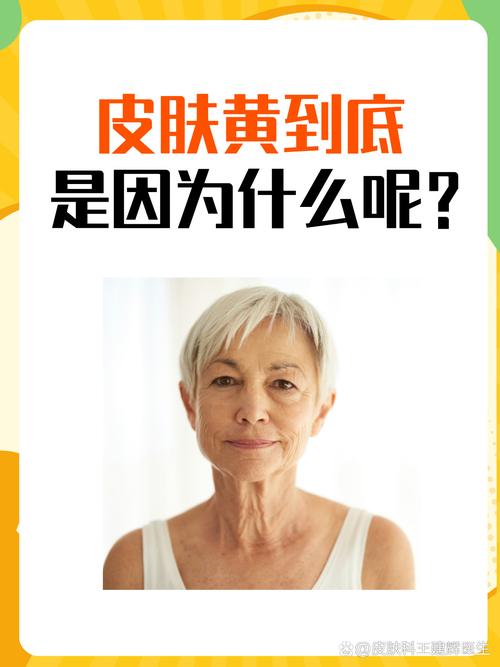 全身皮肤发黄是何原因导致?