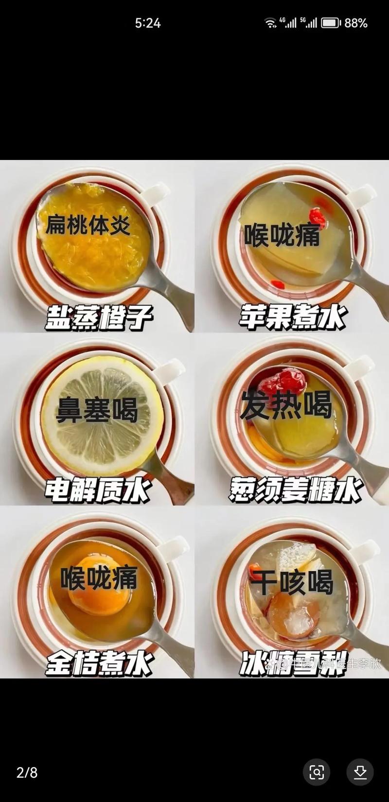 急性化脓性扁桃体炎吃什么食物好?