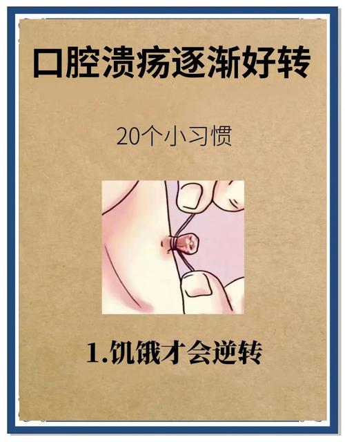 口腔溃疡一个月不愈,为何难好?