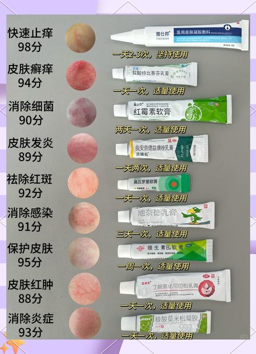 皮肤过敏能用红霉素软膏吗?