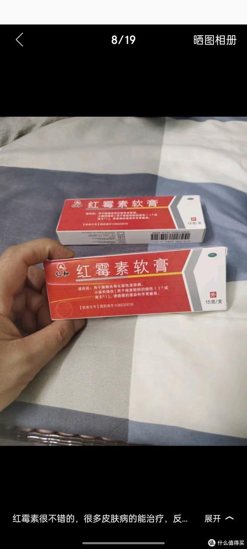 皮肤过敏能用红霉素软膏吗?