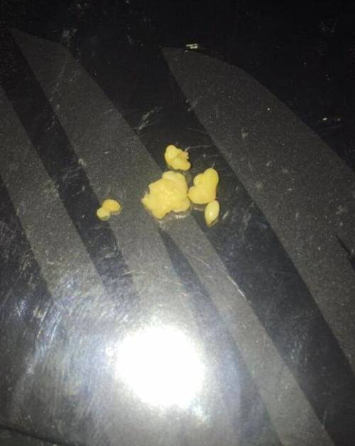 口腔分泌物多是哪些原因导致的?