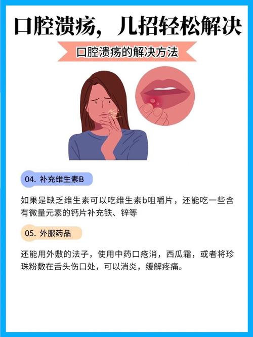 口腔溃疡快速好得快有什么妙招?