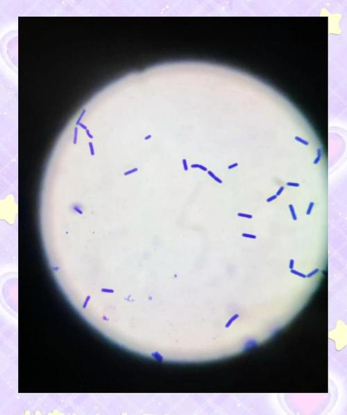 蜡样芽孢杆菌常藏身于哪些食物?