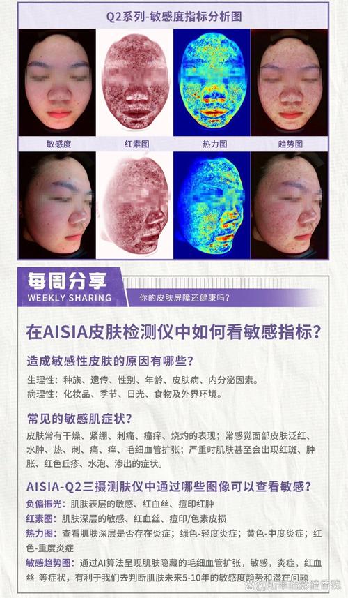 Visia皮肤检测仪价格是多少?