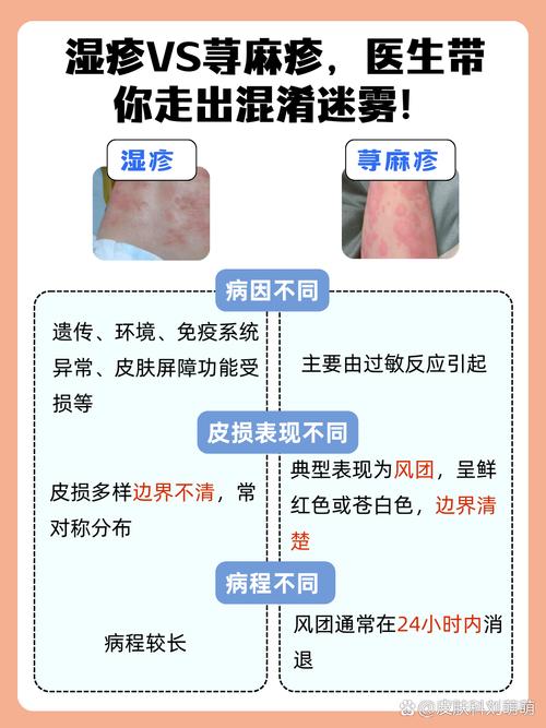 荨麻疹和皮肤过敏是一回事吗?