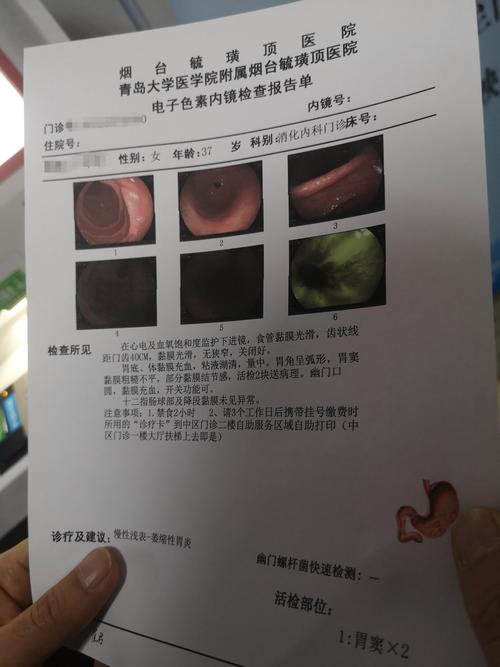 胃镜活检后,吃啥食物最养胃?