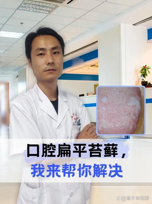 口腔扁平苔藓究竟因何而起?