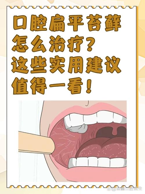 口腔扁平苔藓究竟因何而起?