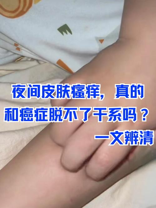 皮肤瘙痒=肾病严重信号?