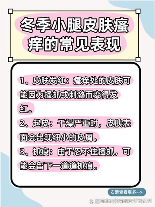 皮肤瘙痒=肾病严重信号?