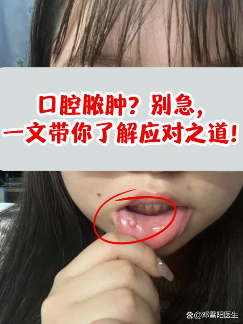 口腔内长肉疙瘩是何原因?