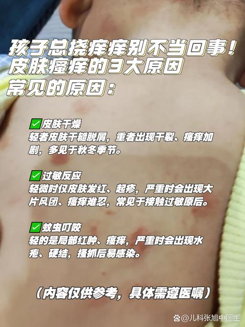 小孩皮肤过敏频发,根源究竟在何处?