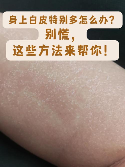 孕期皮肤干燥起皮,该如何缓解?