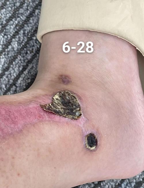 皮肤和软组织创伤愈合分几期?各期特点是什么?