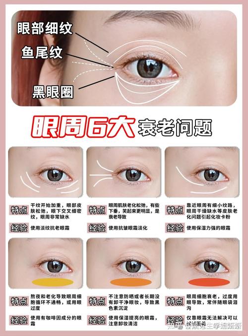眼睛皱纹多、皮肤松弛,怎么改善?