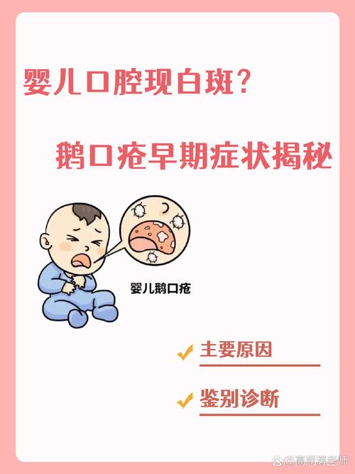 婴儿口腔溃疡和鹅口疮,到底咋区分?