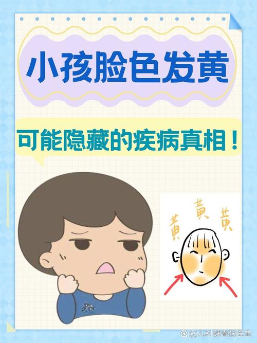 宝宝皮肤黄是哪些原因引起的?