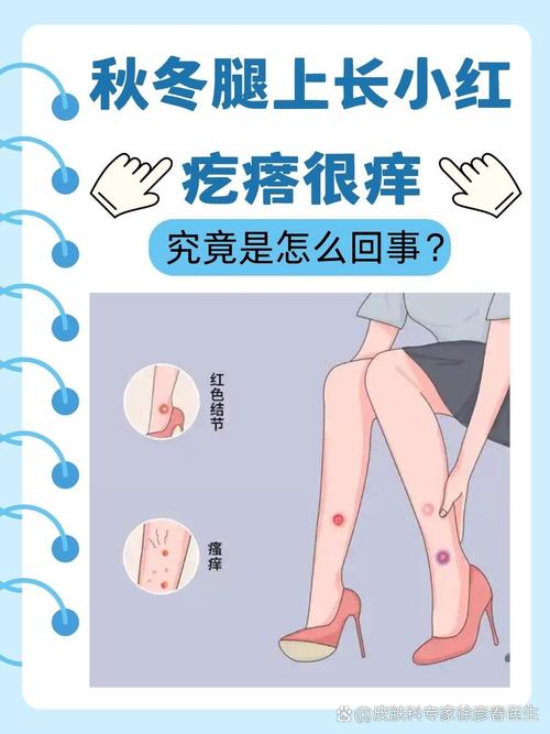 皮肤莫名瘙痒,究竟什么原因?