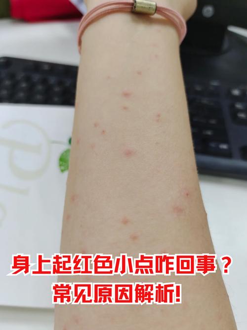 皮肤小红点是过敏还是疾病信号?