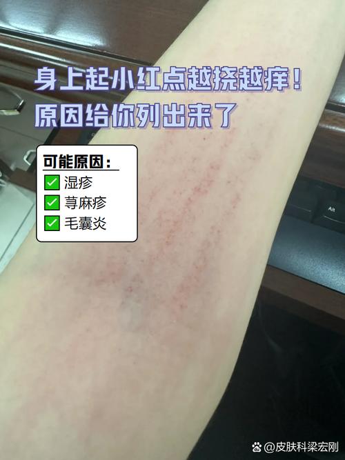 皮肤小红点是过敏还是疾病信号?