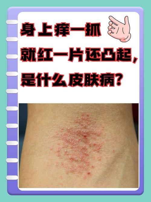 男性全身皮肤瘙痒是什么原因