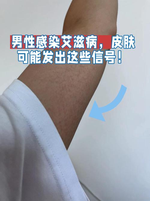 男性全身皮肤瘙痒是什么原因