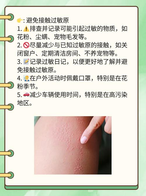 皮肤过敏快速消除,该怎么做?