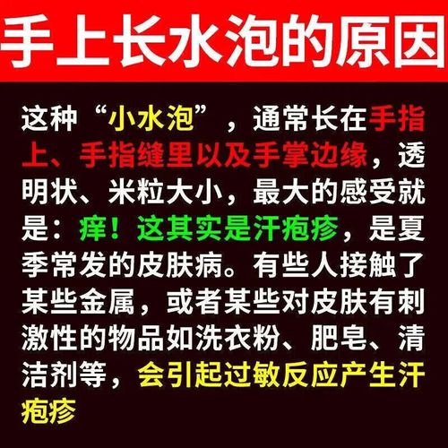 真菌感染皮肤病,哪种药最好?