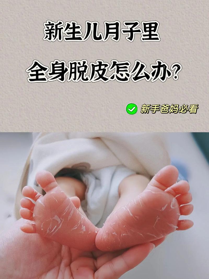 新生儿皮肤干燥脱皮怎么办?