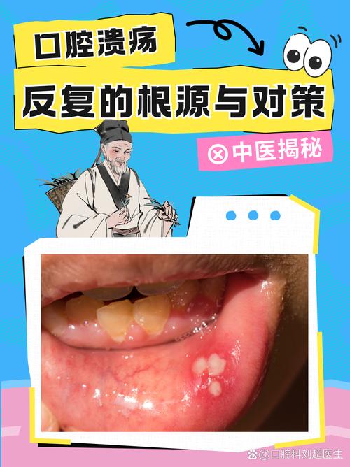 口腔溃疡实火虚火如何分辨?