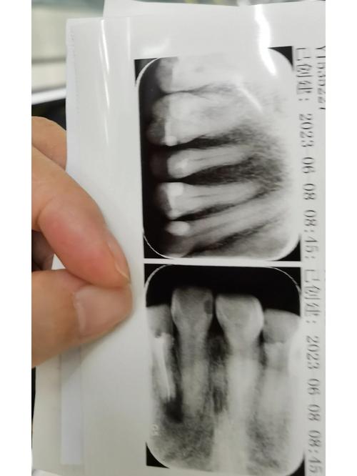 301医院口腔科技术如何?值得信赖吗?