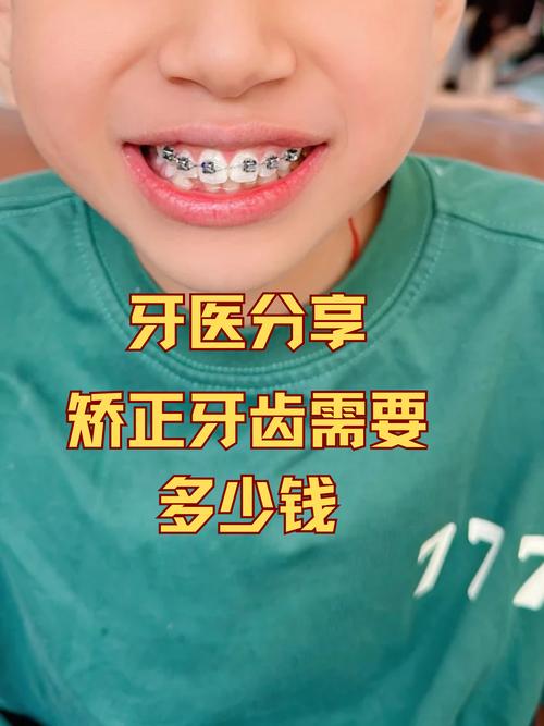 南通口腔医院矫正牙齿多少钱