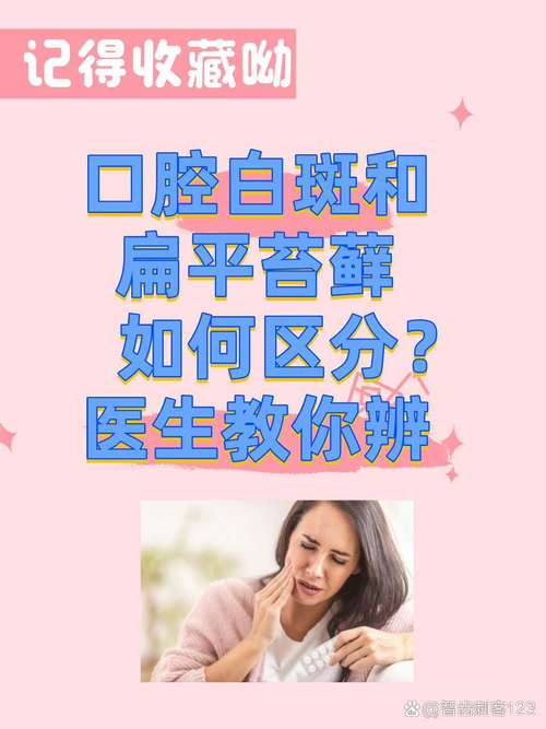 口腔白斑与扁平苔藓,哪个更危险?