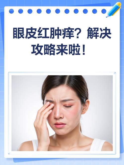 眼周红肿发痒是过敏还是其他问题?