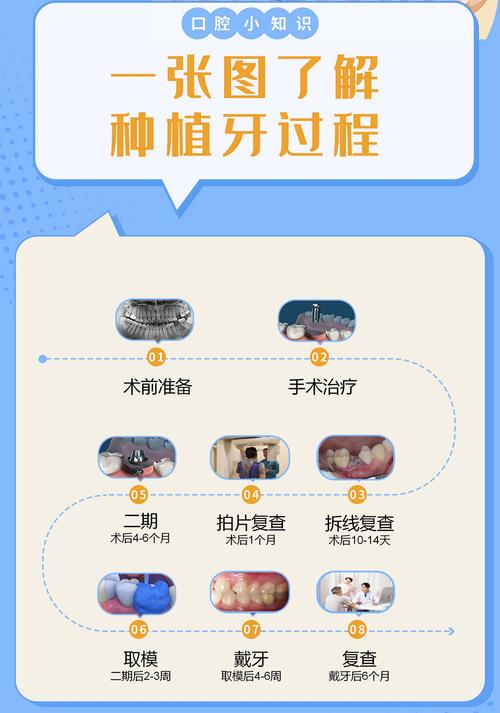 牙齿种植医院怎么选?