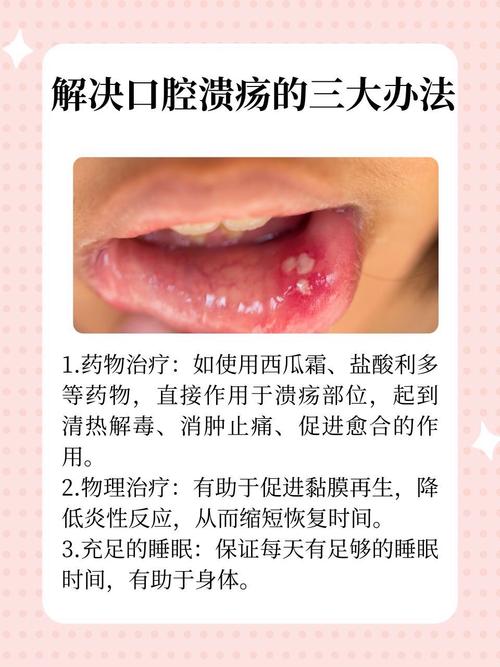 经常嘴巴口腔溃疡是什么原因