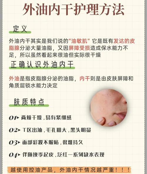 油皮干皮到底哪种皮肤更健康?