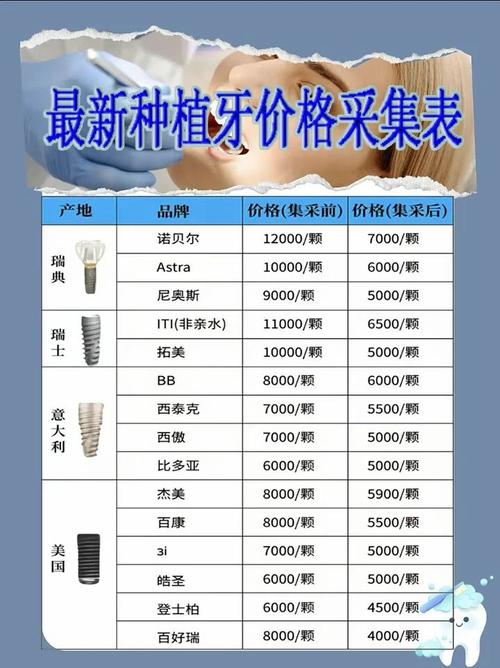 四医大口腔种植牙价格表是怎样的?