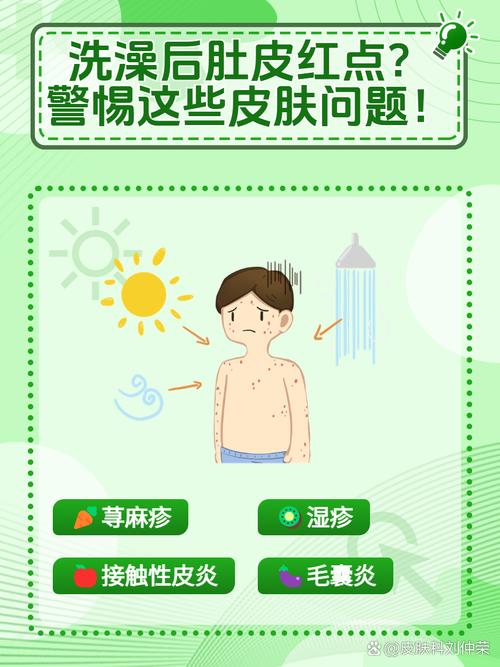 洗完澡皮肤瘙痒是何原因?