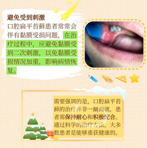 口腔扁平苔藓哪家医院治得好?