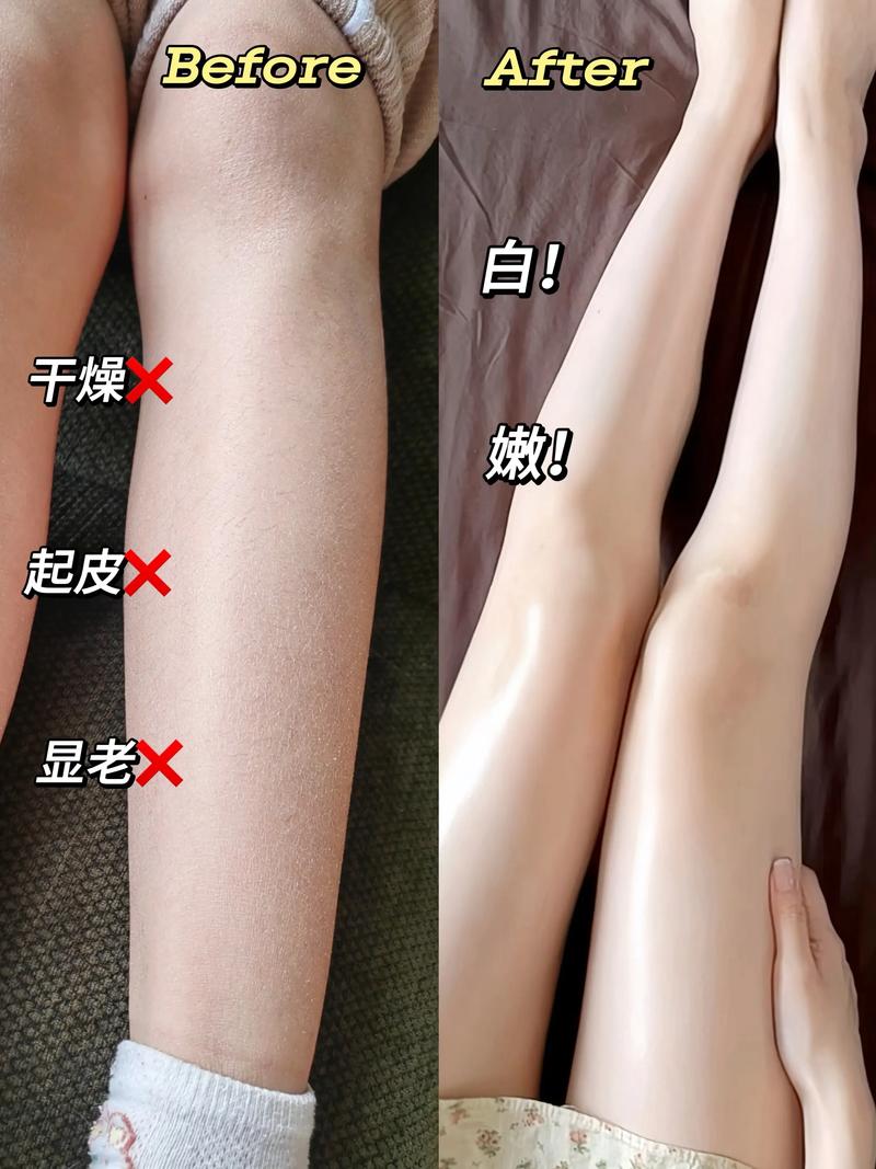 皮肤干燥起皮,身体乳怎么选?