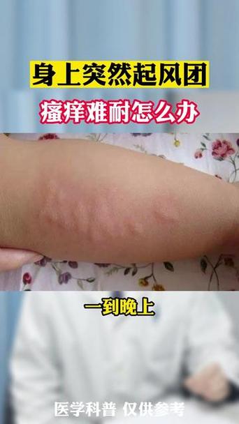 夜间皮肤痒是何原因?