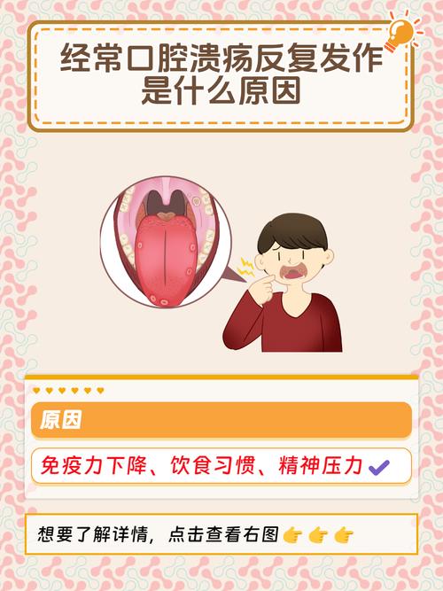 口腔溃疡为何反复发作?