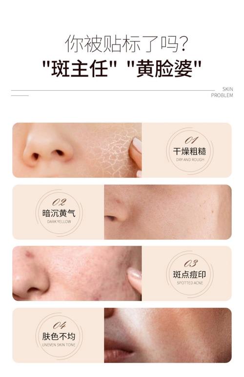 暗黄有斑,护肤品怎么选?